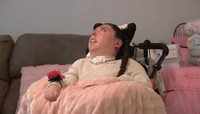 Alex Simpson nasceu com hidranencefalia, uma condição neurológica rara  • YouTube/Reprodução